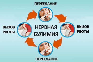 Лечение булимии в Переясловской
